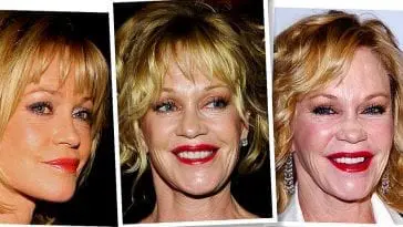 Melanie Griffith przed i po operacjach plastycznych.