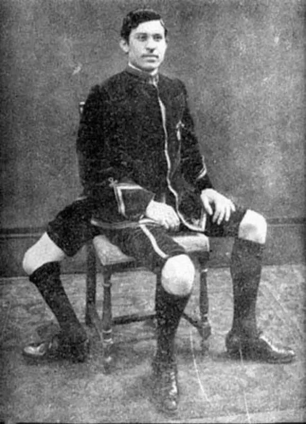 8 najsłynniejszych penisów w historii: fakty, mity i legendy Juan Baptista dos Santos - mężczyzna z dwoma penisami i trzema nogami.