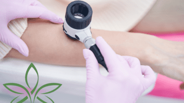 Dermatoskopia – kluczowe narzędzie w diagnostyce chorób skóry