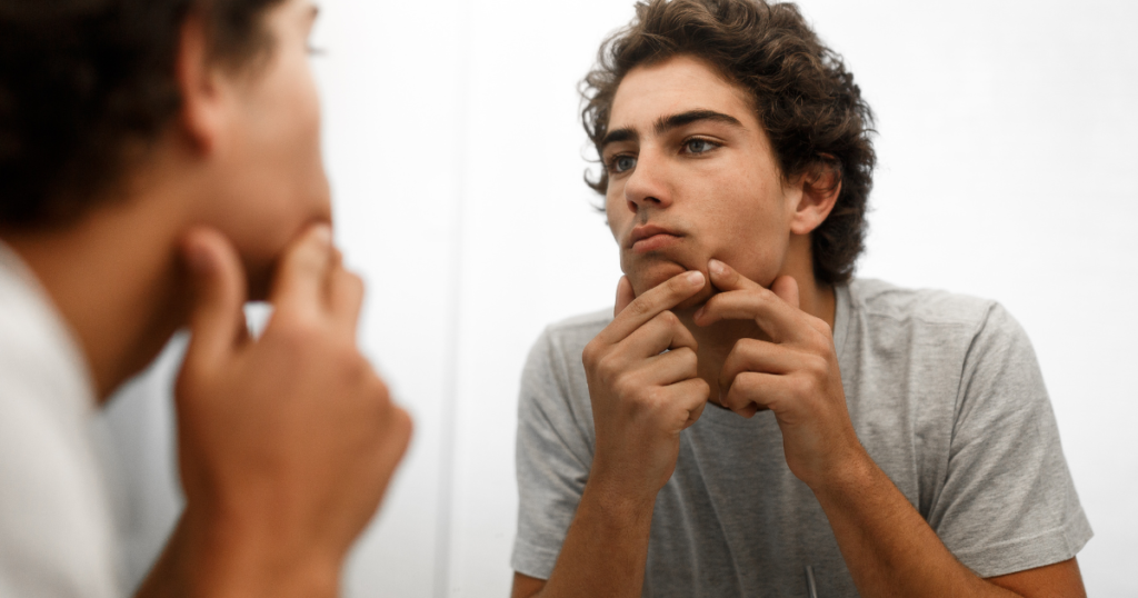 Sennik Wyciskanie Pryszczy: Znaczenie Snu i Interpretacja Symboli Sennik Wyciskanie Pryszczy: Znaczenie Snu i Interpretacja Symboli