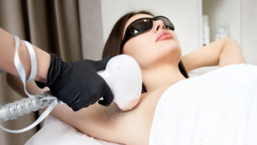 Laserowa depilacja – skuteczny sposób na trwałą gładkość skóry