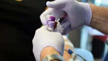 Probówki z krwią do badania profilu lipidowego (lipidogramu)