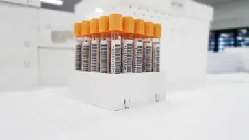 Probówki z próbkami krwi przygotowane do badania hemoglobiny glikowanej HbA1c