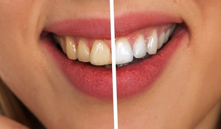 Białe zęby