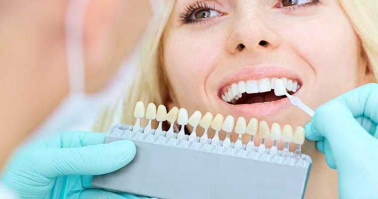 Sprawdzanie odcienia bieli zębów przez stomatologa. 