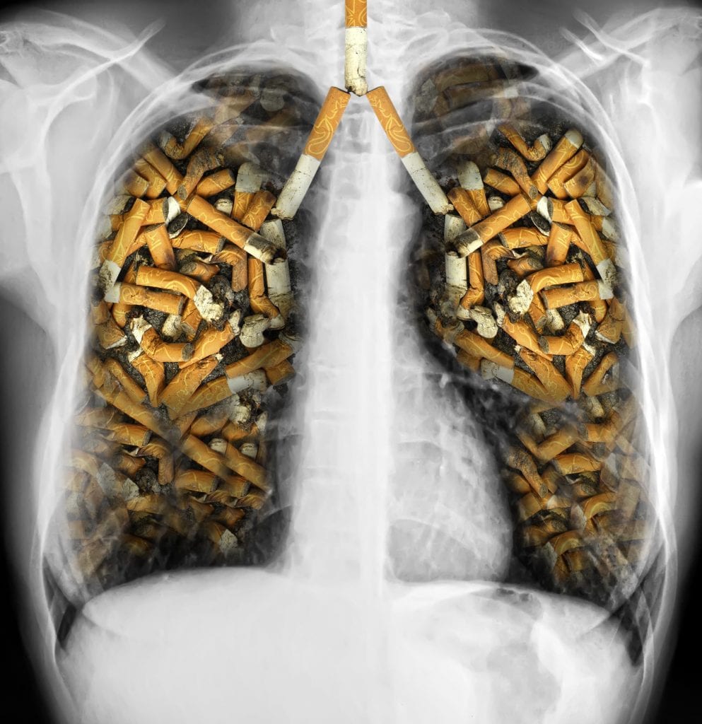 Płuca, wypełnione papierosami.