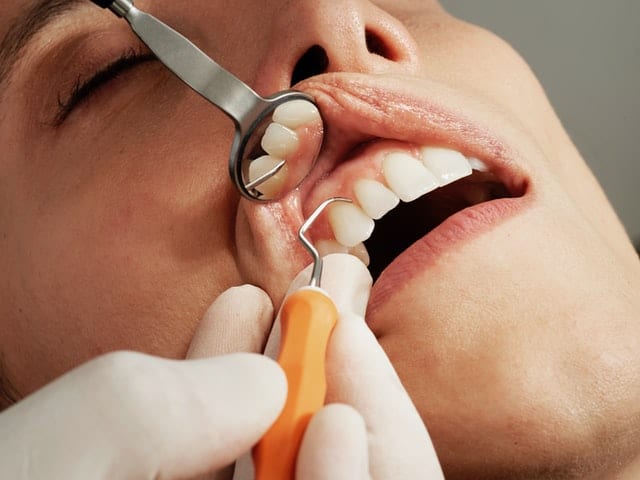 Goździki zwalczą bóle zębów Przegląd zębów i dentysty.