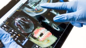 Czy implant zęba może wypaść?