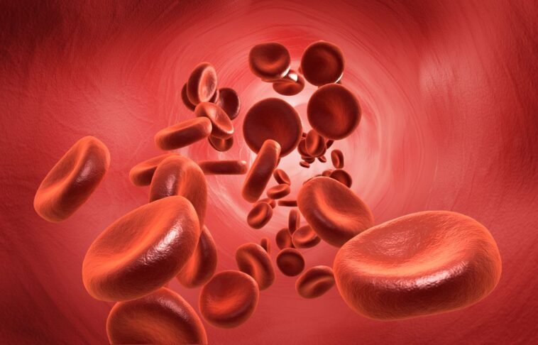 Anemia – coraz częstszy problem zdrowotny. Jak ją rozpoznać i leczyć? Anemia – coraz częstszy problem zdrowotny. Jak ją rozpoznać i leczyć?