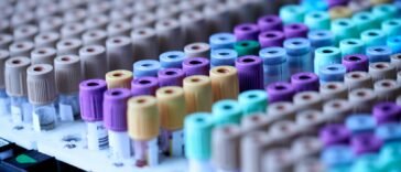 Probówki z pobraną krwią w statywie laboratoryjnym, test wykrywający wiele nowotworów z jednej próbki