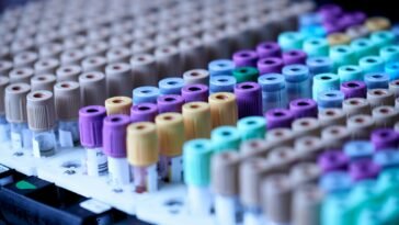 Probówki z pobraną krwią w statywie laboratoryjnym, test wykrywający wiele nowotworów z jednej próbki