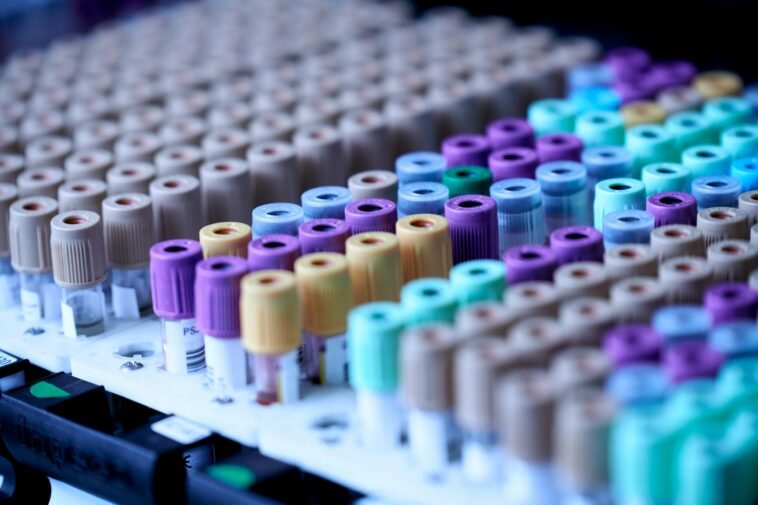 Jedna próbka krwi, ponad 50 nowotworów. Największe badanie w historii dało wynik, który podzielił onkologów Probówki z pobraną krwią w statywie laboratoryjnym, test wykrywający wiele nowotworów z jednej próbki