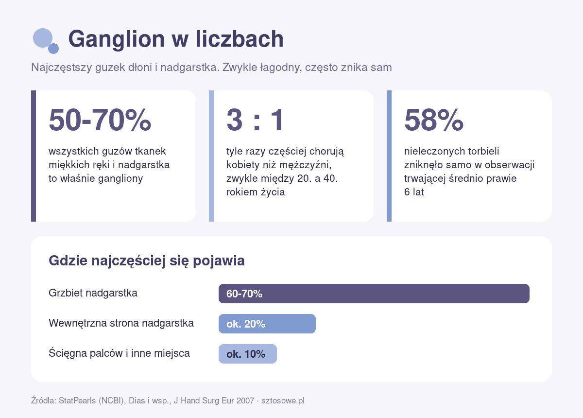 Infografika: ganglion w liczbach, czyli jak często występuje torbiel galaretowata, kogo dotyczy i gdzie najczęściej się pojawia