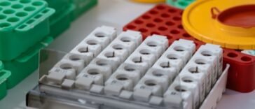 Próbki krwi w probówkach w laboratorium podczas oznaczania grupy krwi