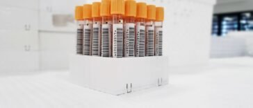 Probówki z próbkami krwi przygotowane do badania hemoglobiny glikowanej HbA1c