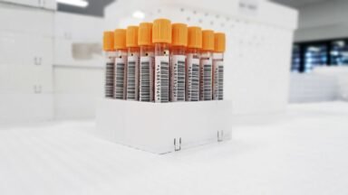 Probówki z próbkami krwi przygotowane do badania hemoglobiny glikowanej HbA1c