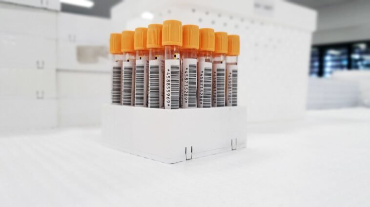 Probówki z próbkami krwi przygotowane do badania hemoglobiny glikowanej HbA1c