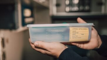 Dłonie w rękawiczkach trzymające pojemnik z próbką moczu do badania laboratoryjnego
