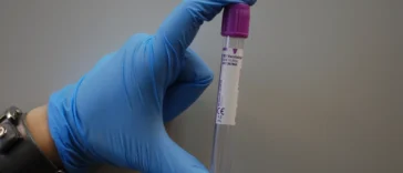 Probówka z próbką krwi do badania laboratoryjnego