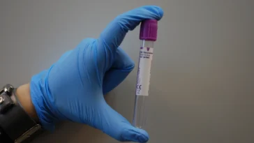 Probówka z próbką krwi do badania laboratoryjnego