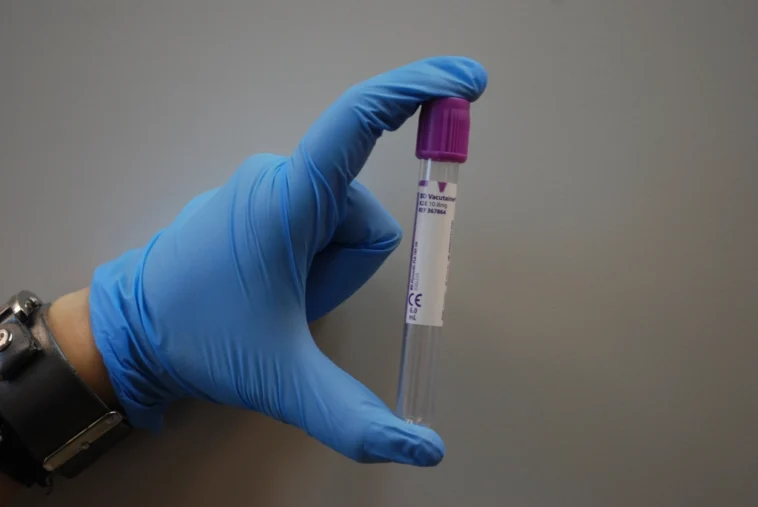 Probówka z próbką krwi do badania laboratoryjnego